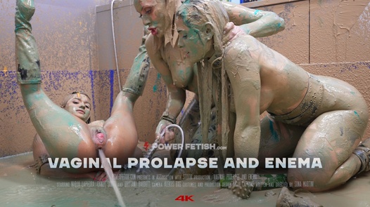 脱垂的阴道 10-3